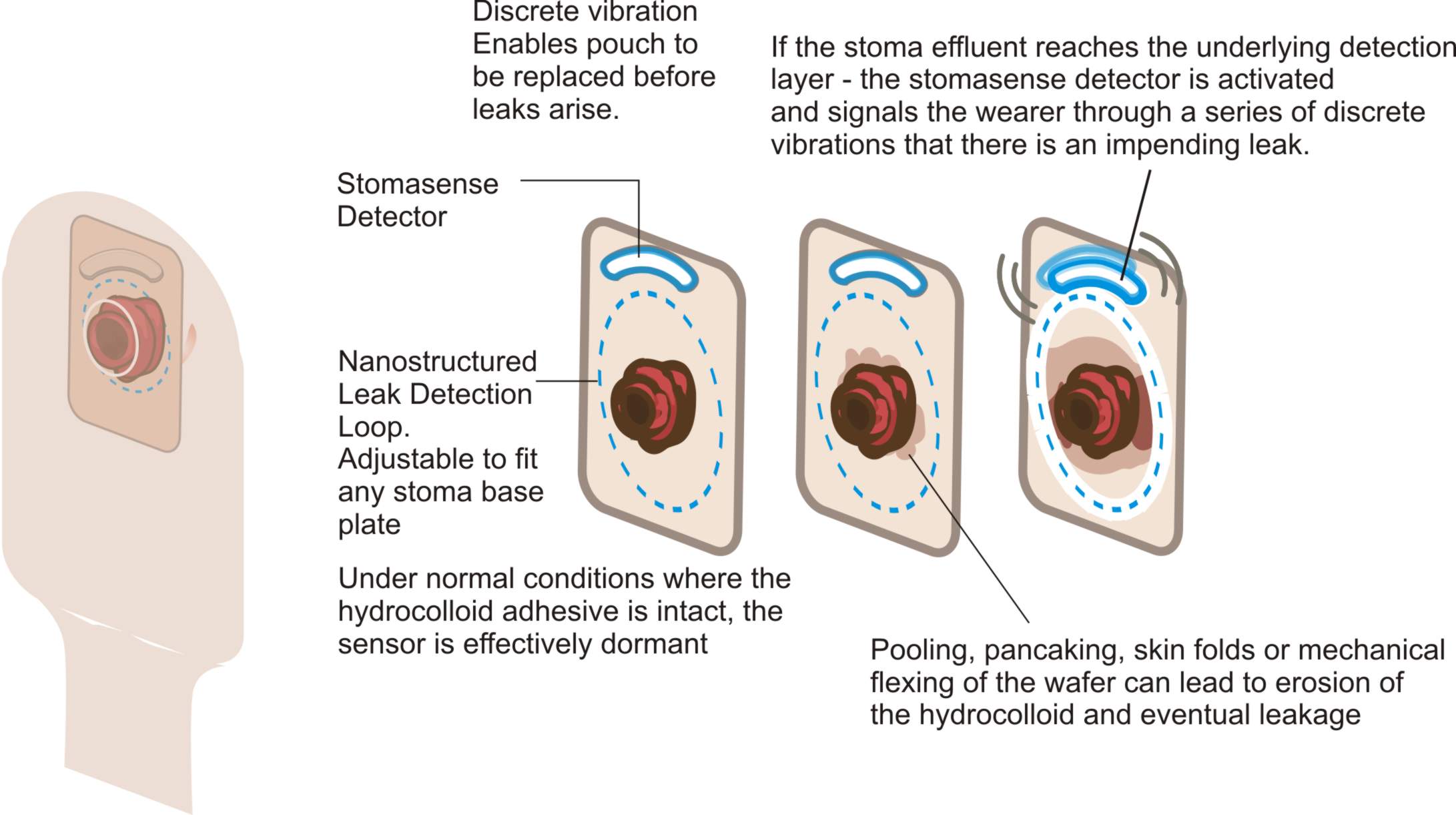 stomasense-about-page-1